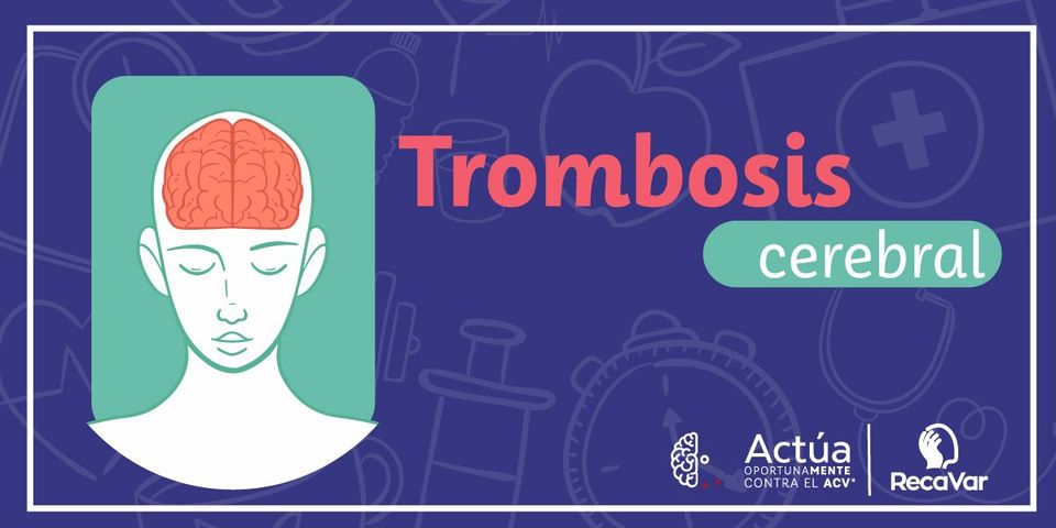 Trombosis Cerebral - The etiology is multifactorial and the ...